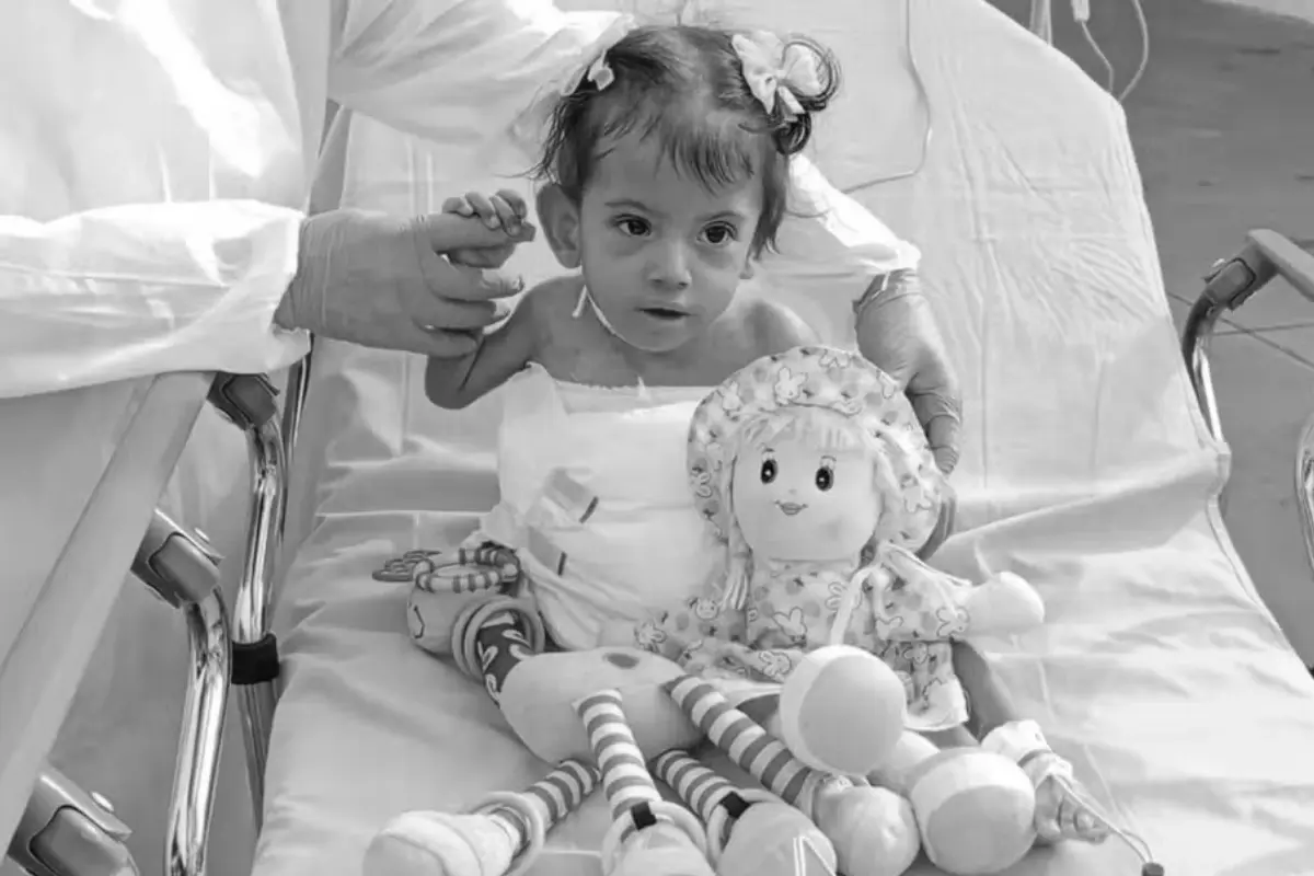 Aruna: morre siamesa que havia sobrevivido à separação em 10 de maio em Goiânia