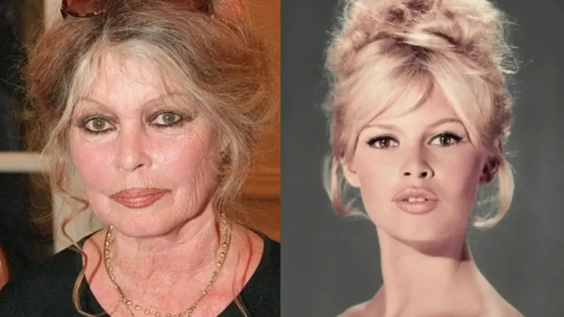 Brigitte Bardot comparou gravidez a tumor, foi racista e xenofóbica