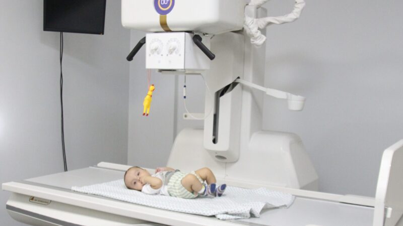 Hecad passa de 1 milhão de exames e reforça pediatria em Goiás