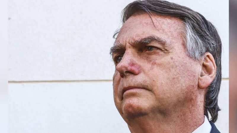 Apneia do sono e CPAP: entenda distúrbio que afeta Bolsonaro e o tratamento