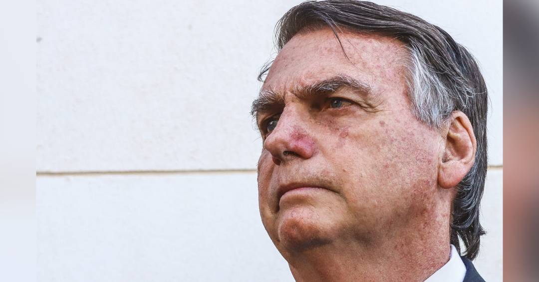 Apneia do sono e CPAP: entenda distúrbio que afeta Bolsonaro e o tratamento