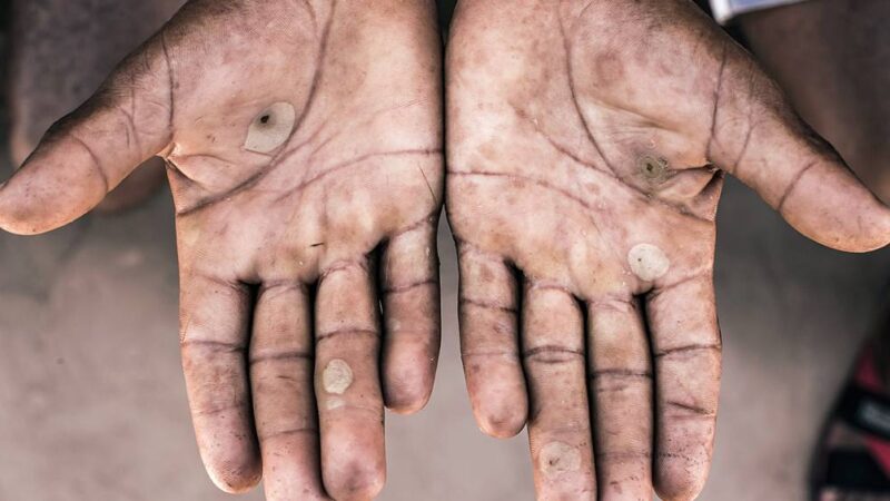 Brasil bate recorde de denúncias de trabalho escravo