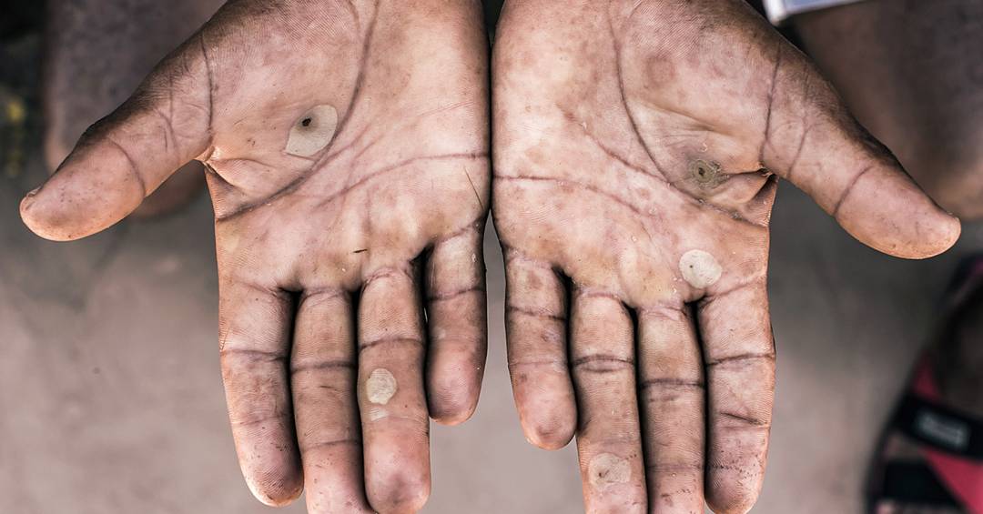 Brasil bate recorde de denúncias de trabalho escravo