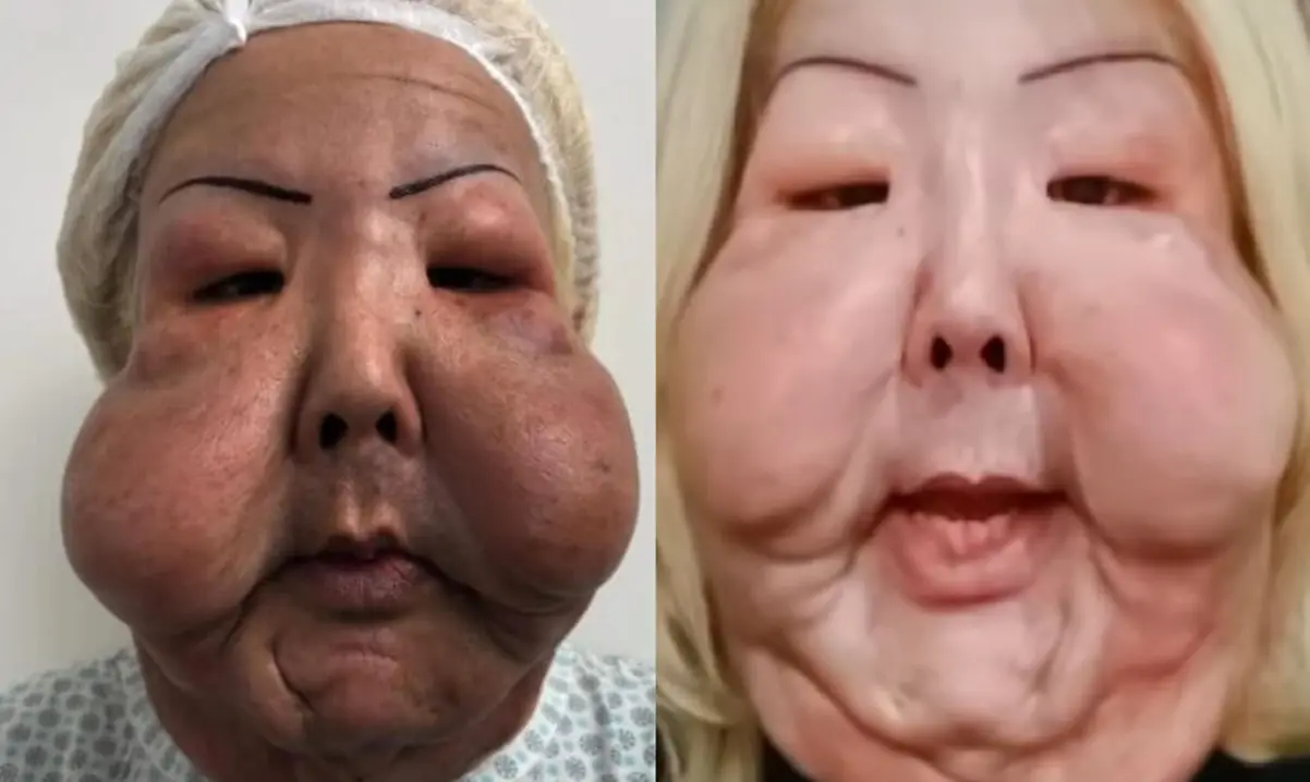 veja óleo mineral retirado do rosto de Juju do Pix