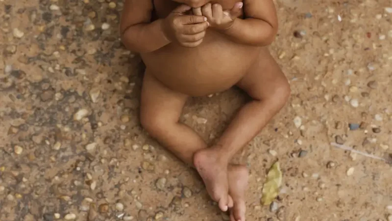 Vulnerabilidade afeta crescimento e sobrepeso infantil