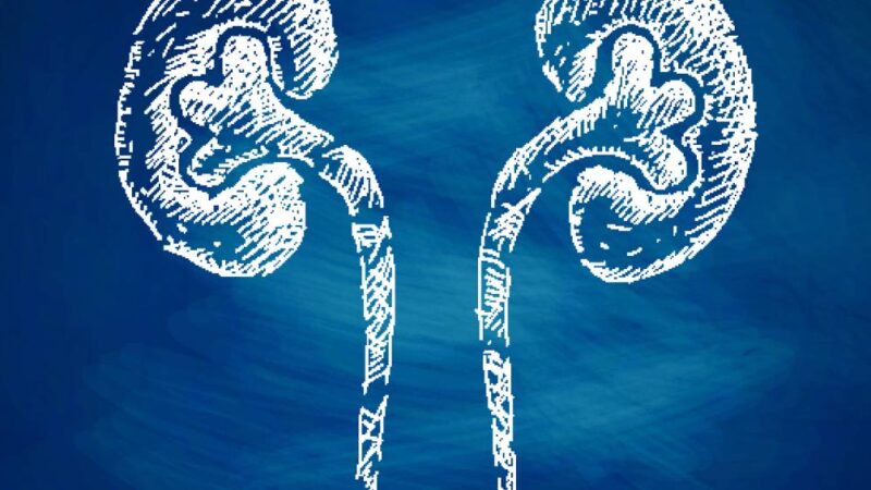 Pedras nos rins: problema pode ser silencioso e se agravar nesta época