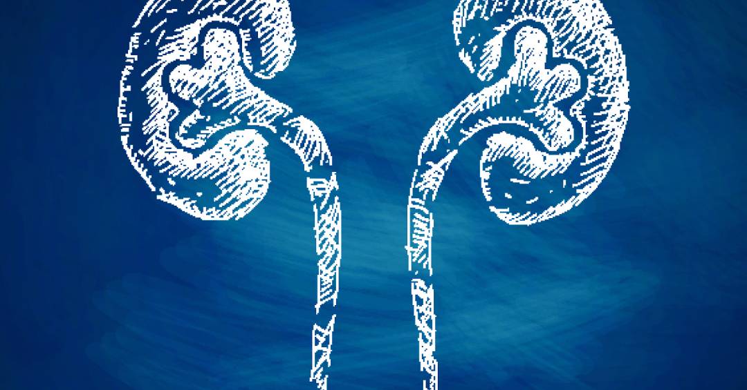 Pedras nos rins: problema pode ser silencioso e se agravar nesta época