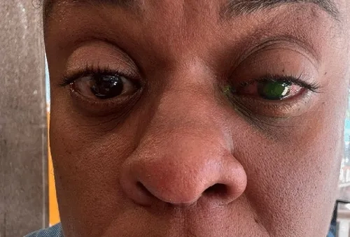 Cacau Protásio se recupera após reação a pomada capilar