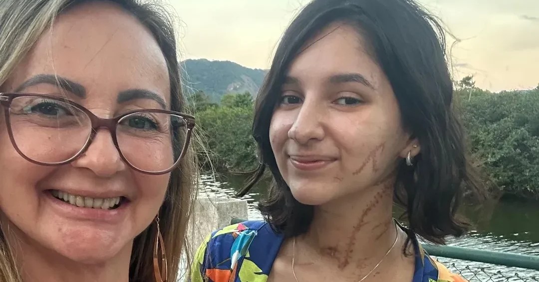 Jovem esfaqueada trinta vezes sai de casa pela primeira vez após receber alta