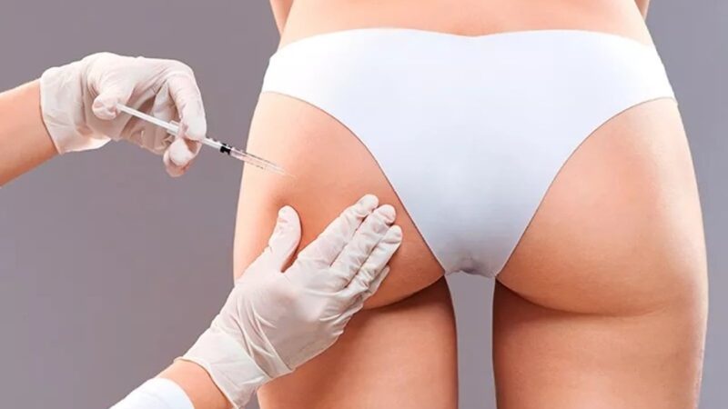 Sociedade Brasileira de Dermatologia defende suspensão do PMMA em procedimentos estéticos