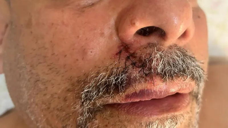 Acusado de racismo, ex-presidente do Vila fala de agressão, gesto e afirma: “denúncia caluniosa”