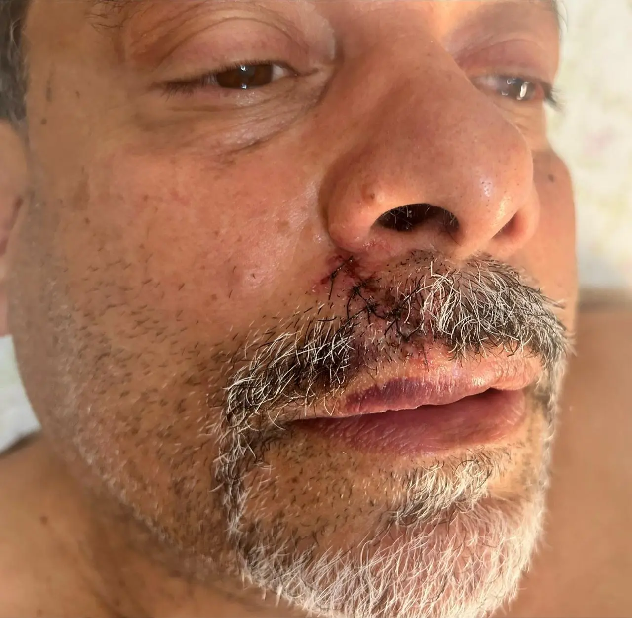 Acusado de racismo, ex-presidente do Vila fala de agressão, gesto e afirma: “denúncia caluniosa”