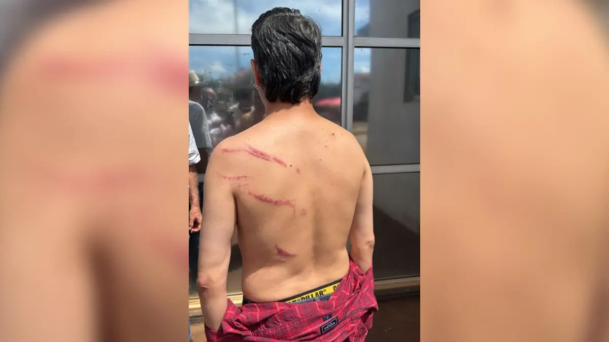 Preso em ato do MST em Goiás, vereador depõe à polícia, é liberado e faz corpo de delito