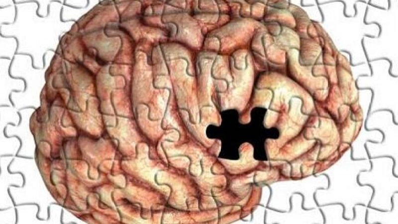 FHC e o Alzheimer: entenda doença: Alzheimer: entenda os estágios da doença que afeta ex-presidente FHC