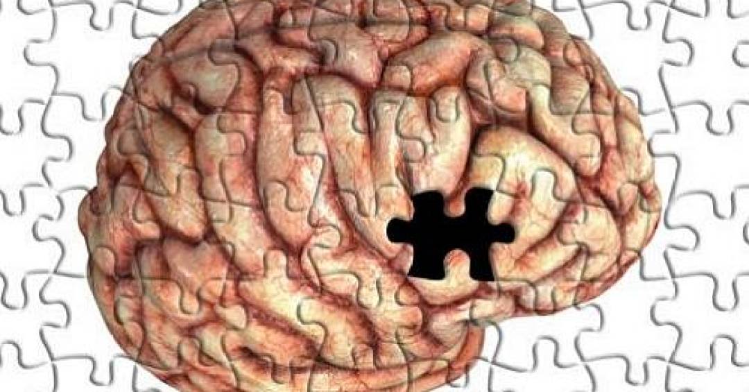 FHC e o Alzheimer: entenda doença: Alzheimer: entenda os estágios da doença que afeta ex-presidente FHC