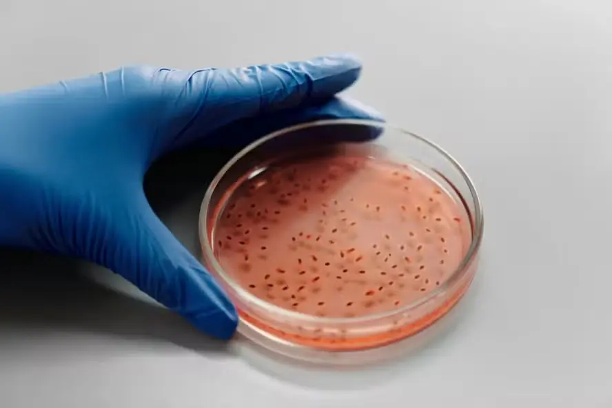 Cientistas fazem descoberta sobre a bactéria encontrada nos produtos Ypê