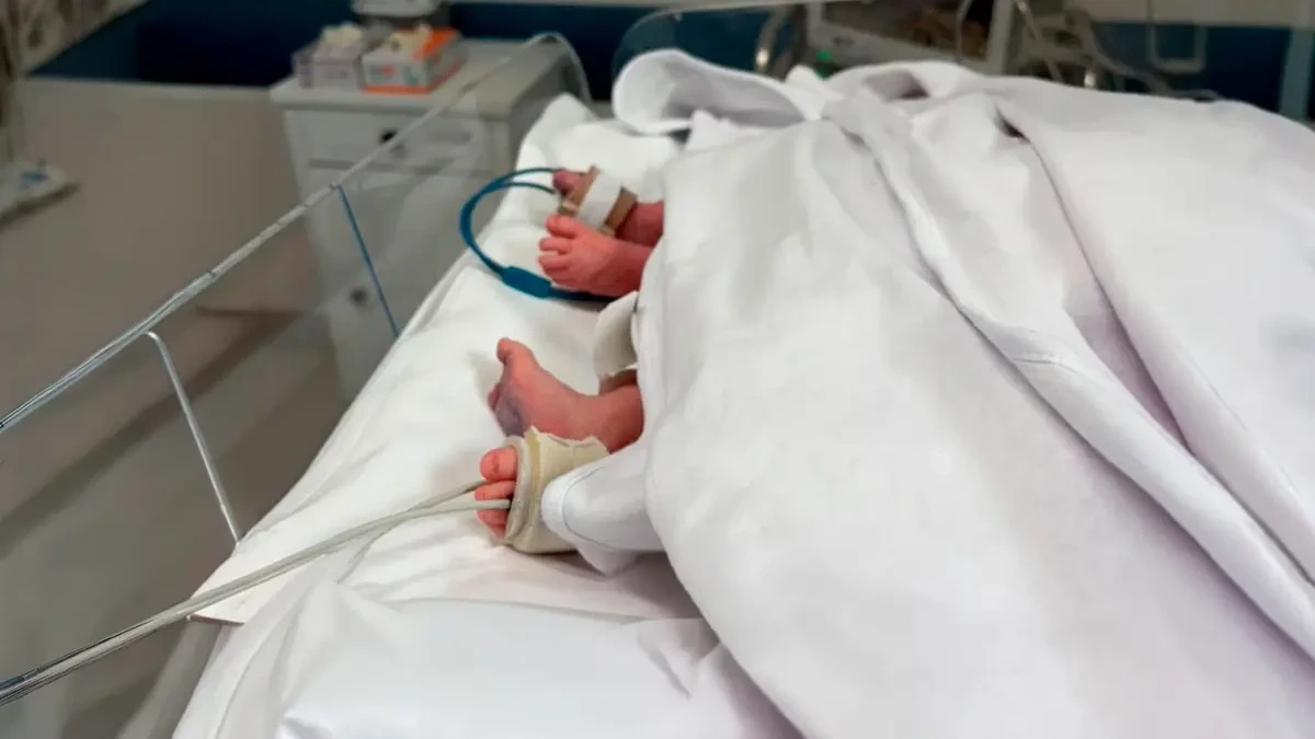 Siameses morrem após complicações infecciosas em Goiânia
