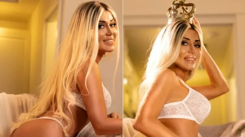 Mulher Abacaxi revela transição de gênero; veja foto do antes