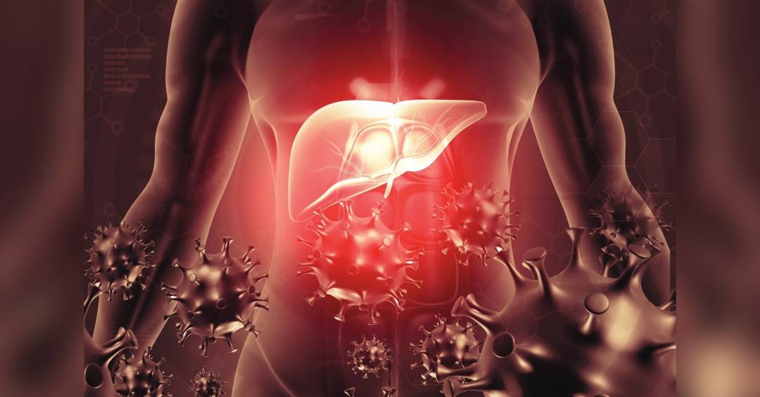 Medicamento capaz de ‘curar’ hepatite recebe primeira aprovação no mundo