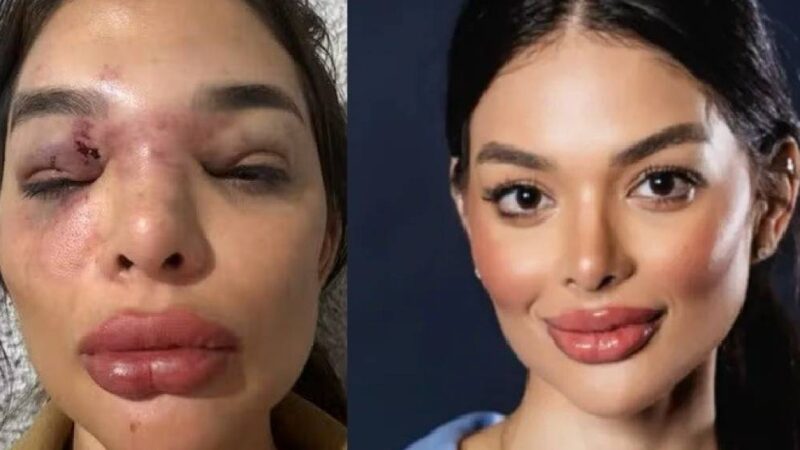 O que se sabe até agora sobre o caso de agressão de dentista por empresário da Faria Lima