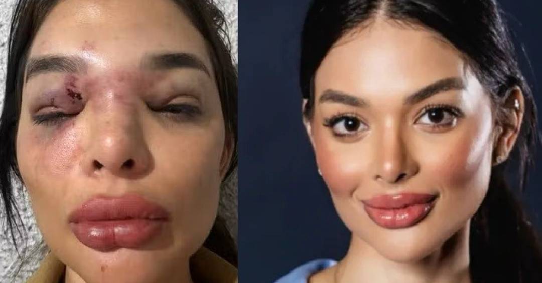 O que se sabe até agora sobre o caso de agressão de dentista por empresário da Faria Lima